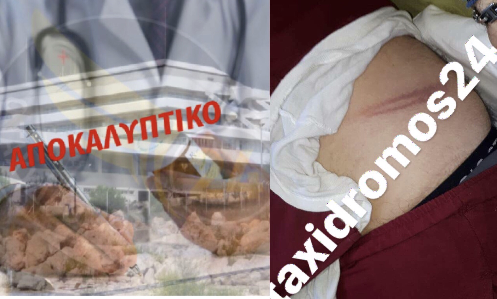 ΑΠΟΚΑΛΥΠΤΙΚΟ - Πάφος: Ασθενής «μαινόμενος ταύρος» επιτέθηκε σε γιατρό - Του «γύρισε» το μπαστούνι - ΦΩΤΟΓΡΑΦΙΕΣ